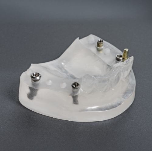 Model of lower jaw with All on 4 dental implants in Arlington Heights