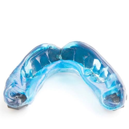 A customized athletic mouthguard