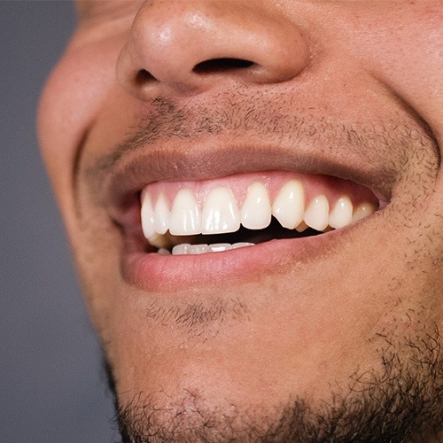 Man sharing smile after dental bonding