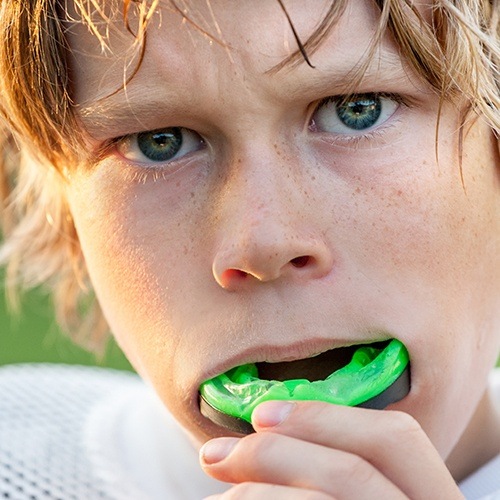 Teen placing an athletic mouthguard