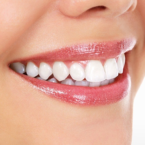 Close up of smile with flawless white teeth