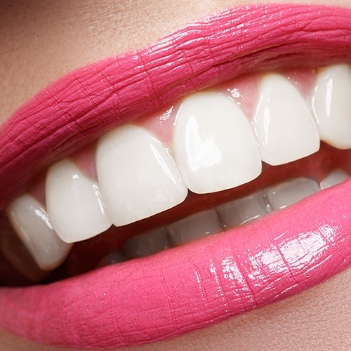 Close up of smile with flawless teeth and even gumline