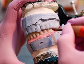 Heights (The Denture Creation Process IMAGE)