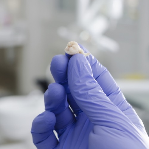 Woman sharing smile after replacing extracted tooth