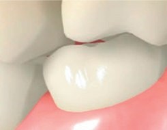 Illustrated close up of upper and lower teeth touching