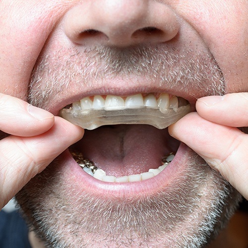 Close up of man placing a mouthguard over his teeth