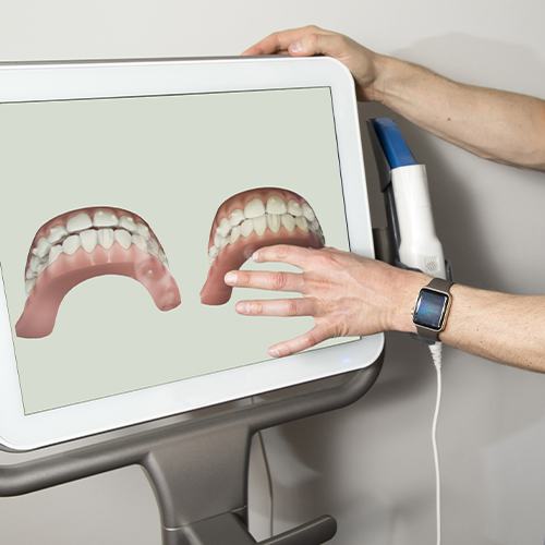 Dentist pointing to Invisalign smile design on computer