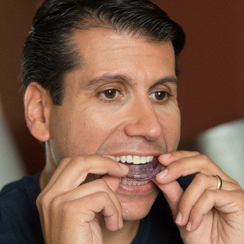 Man placing a sleep apnea oral appliance over his teeth