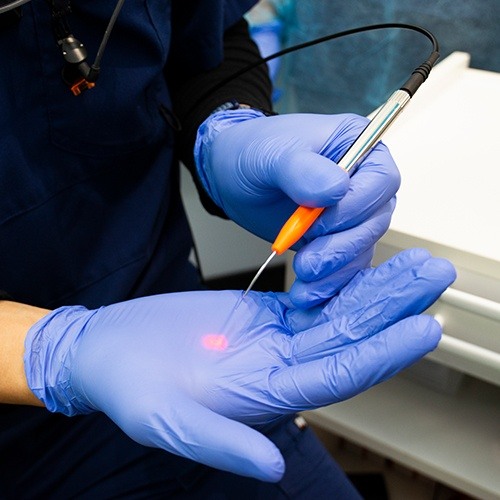 Gloved hands holding a pen like dental laser device