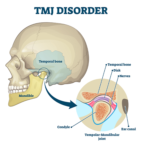 Man in need of T M J therapy holding head in pain