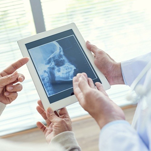 Dentists reviewing x-rays of jaw and skull bone