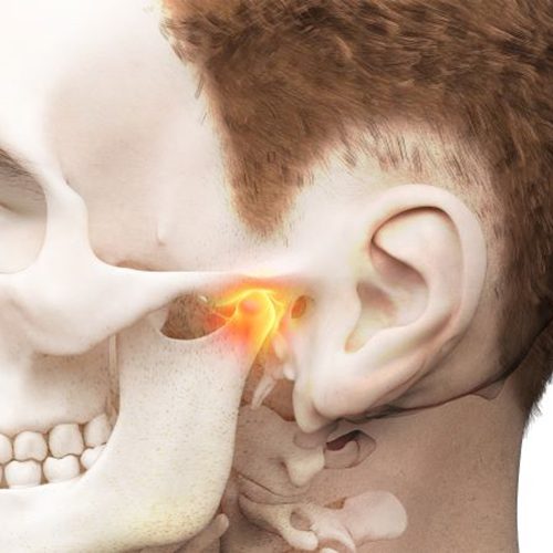 Illustration of head with T M J highlighted