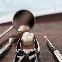 Extracted tooth in forceps resting on table