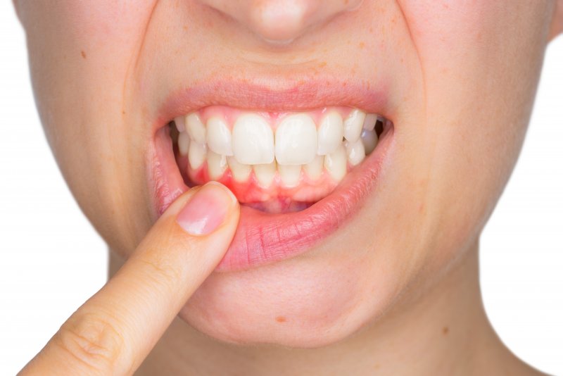 person pointing to inflamed gums