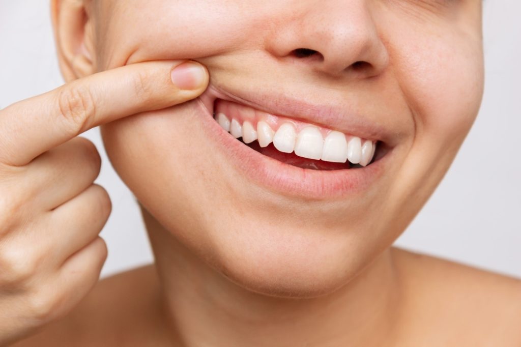 Smiling woman showing her healthy gums