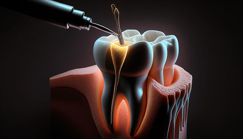 a digital image of a root canal